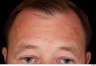 Louis forehead head 0001.jpg